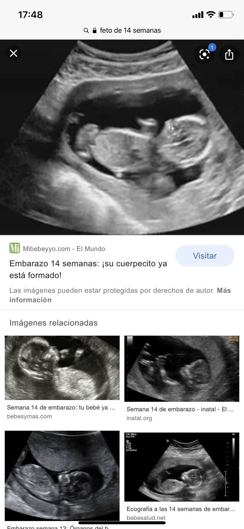 inatal - El embarazo semana a semana - inatal - El embarazo semana a semana