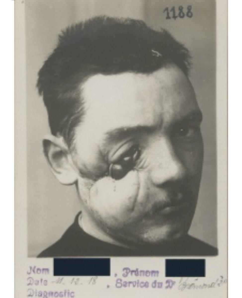 This is a soldier from France.