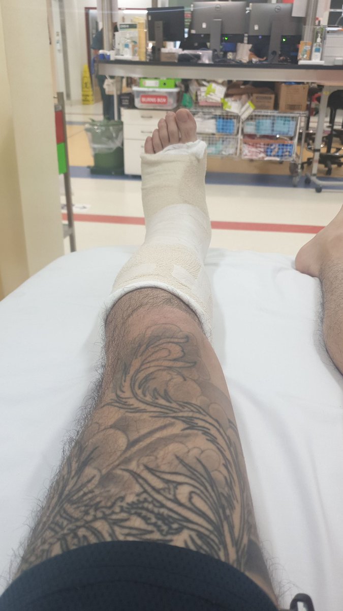 te27opp41's tweet photo. It broke my ankle, but am i glad to be able to ride it again. Its been a long 7 weeks T_T https://t.co/AXqFuDcGAk