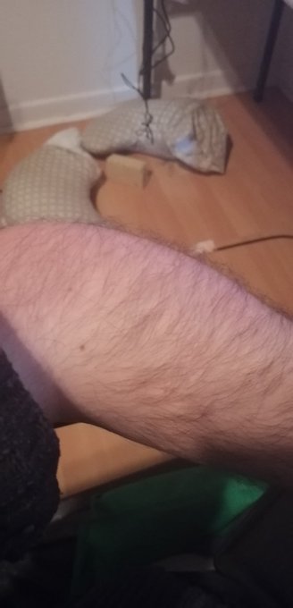 My elbow has decided to swell up. https://t.co/kCgQZfGpFE