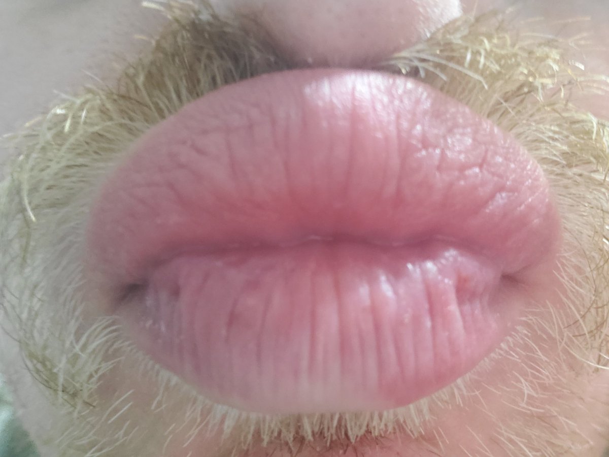 Gusbuckets's tweet photo. in case you do not have any lips to kiss on new years here you can kiss my lips on your screen https://t.co/UK9kIpvn2y