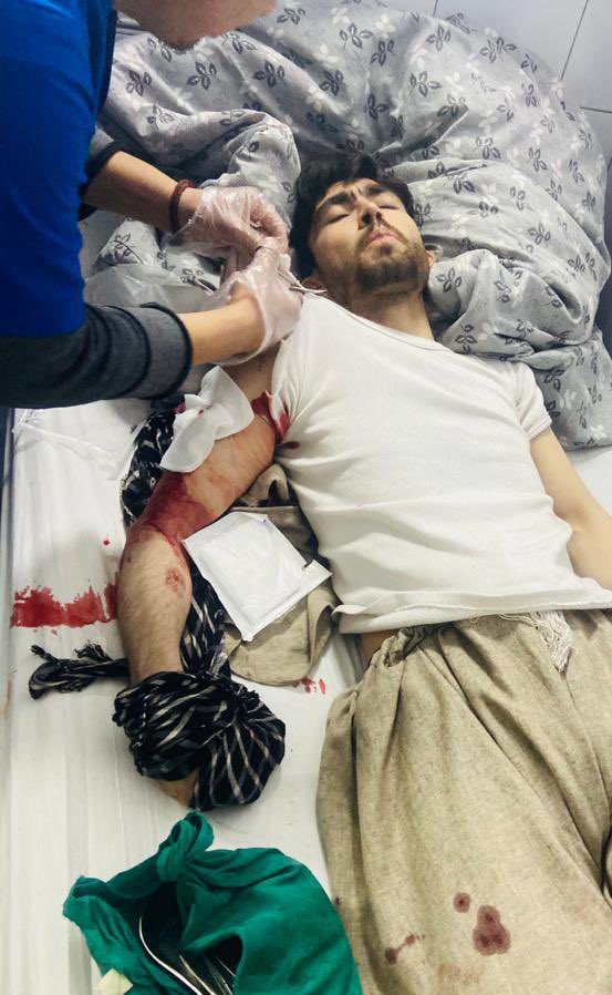 ikramuddine's tweet photo. 2020 ended with this horrible incident, Thieves hit my with knives.. #Kabul_is_NOT_Safe https://t.co/UMcCuEbXNH