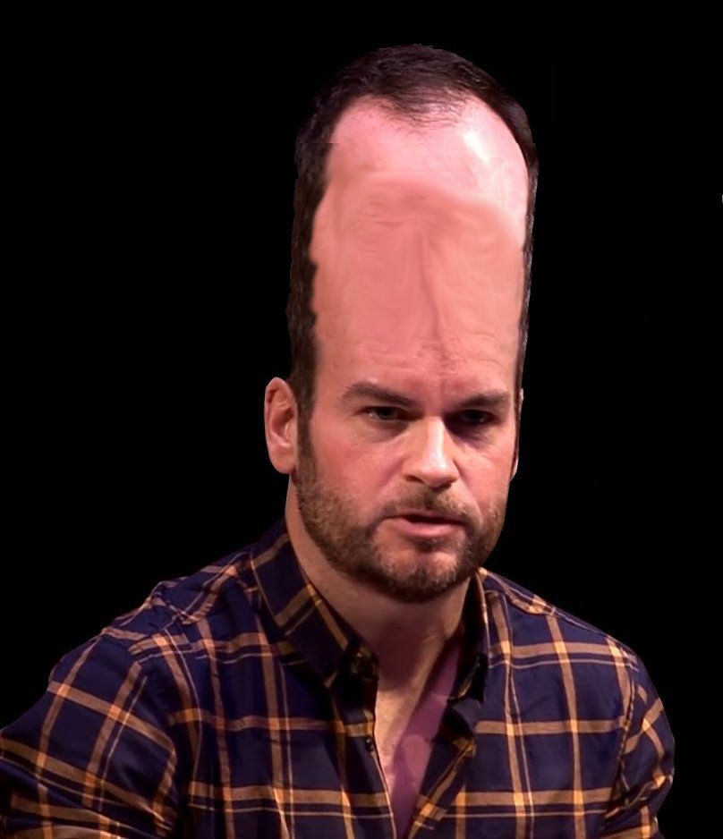 The vein on his forehead there is about to burst.