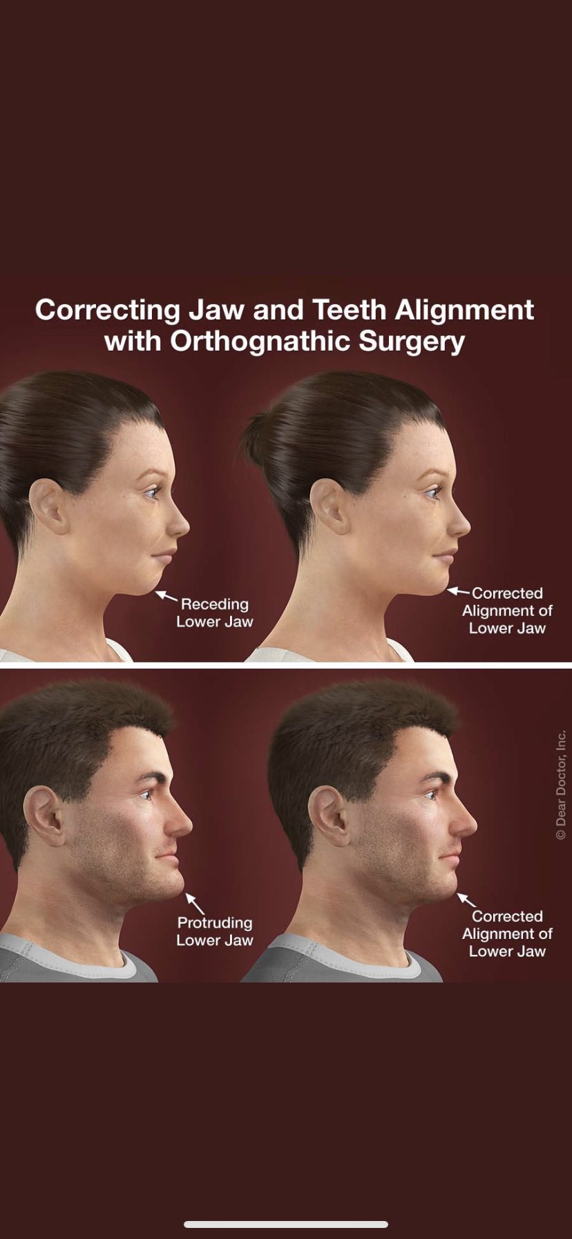 PLASTIC SURGERY CONSULTANT on Twitter "𝙅𝙖𝙬 𝙎𝙪𝙧𝙜𝙚𝙧𝙮/ 𝙊𝙧𝙩𝙝𝙤𝙜𝙣𝙖𝙩𝙝𝙞𝙘