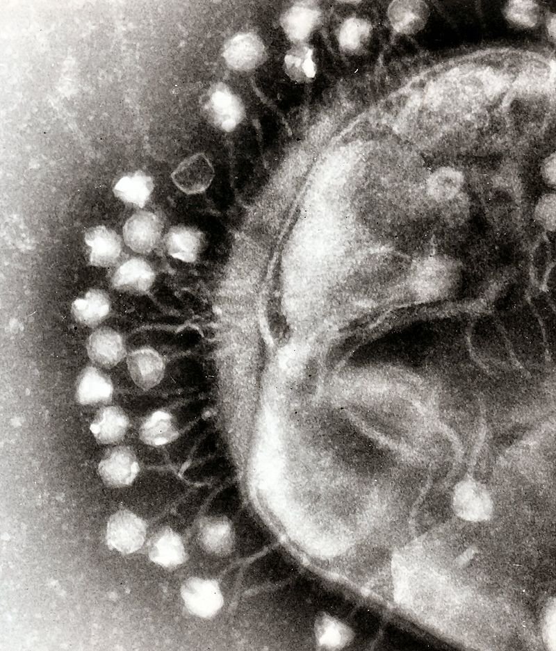 And here's a bunch of phages attacking a bacterium. (Both images from Wikipedia.)