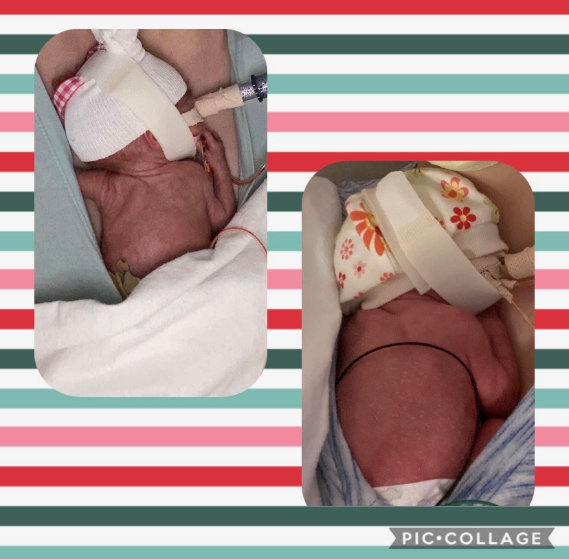 KoyneSteph's tweet photo. Grandbaby....1lb 4 ounces 3 weeks ago. Today 1lb 15 ounces. Huge difference...past test this week so no open heart this week. Meet again next week. @imAnimagus @profLynette @Xpecto_GO she is going strong!! https://t.co/uo0LuIhEV8