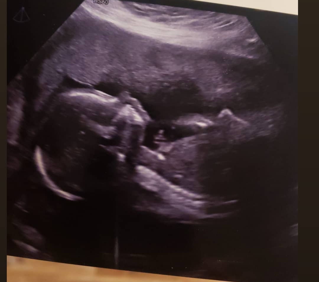 Andreasoliz24's tweet photo. 2020 has been soooo CRAZY but also so beautiful 💖 got married to my high-school sweetheart, moved, new job, baby coming soon &amp; we got a new fur baby 🥺💕 #Blessed #Hello2021 #HappyNewYear https://t.co/S3jy5nWdQg
