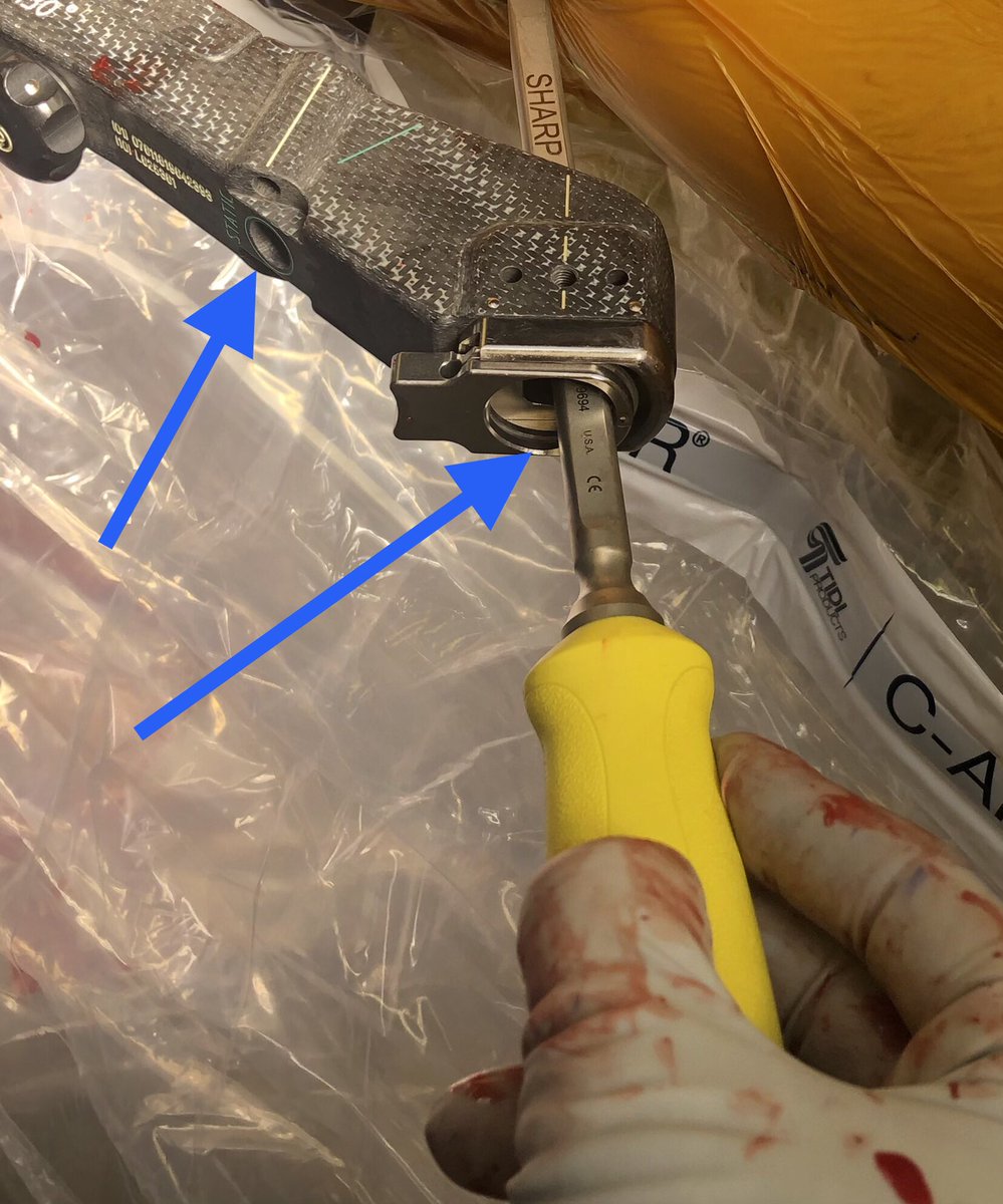 [10/18] At least in Synthes set they have long knife I call Big Bird. You can stick it through sleeve holes to get soft tissue trajectory right away instead of moving jig to use regular knife (sometimes you’ll still need it anyway, as excursion of Big Bird not always extensive).