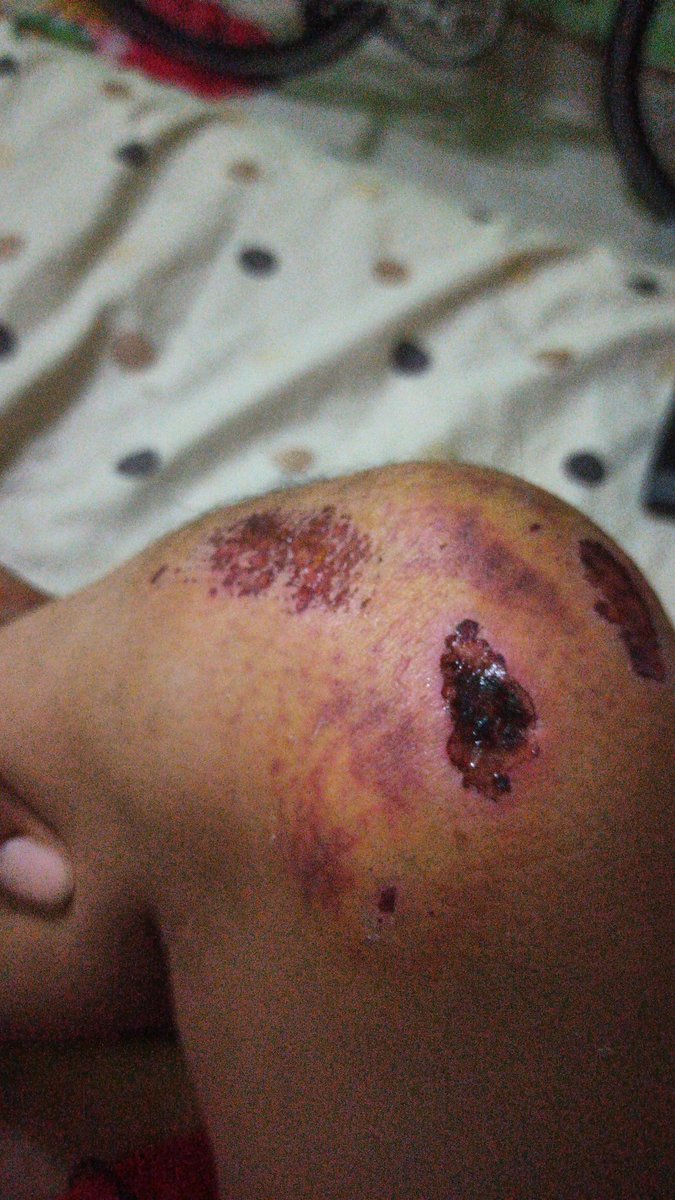 RyanMSDC's tweet photo. Efek bersetubuh dengan aspal... https://t.co/pwds96oBYL