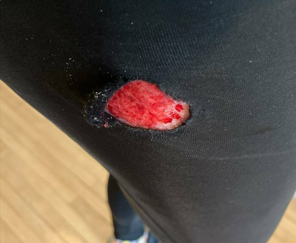 niallk40's tweet photo. Itโs icy out there. ๐ฅถ Take care (at least more than I did...) #cycling #glasgow #icy #ridefail https://t.co/dn3ddUogHJ https://t.co/dpQvYt9yop