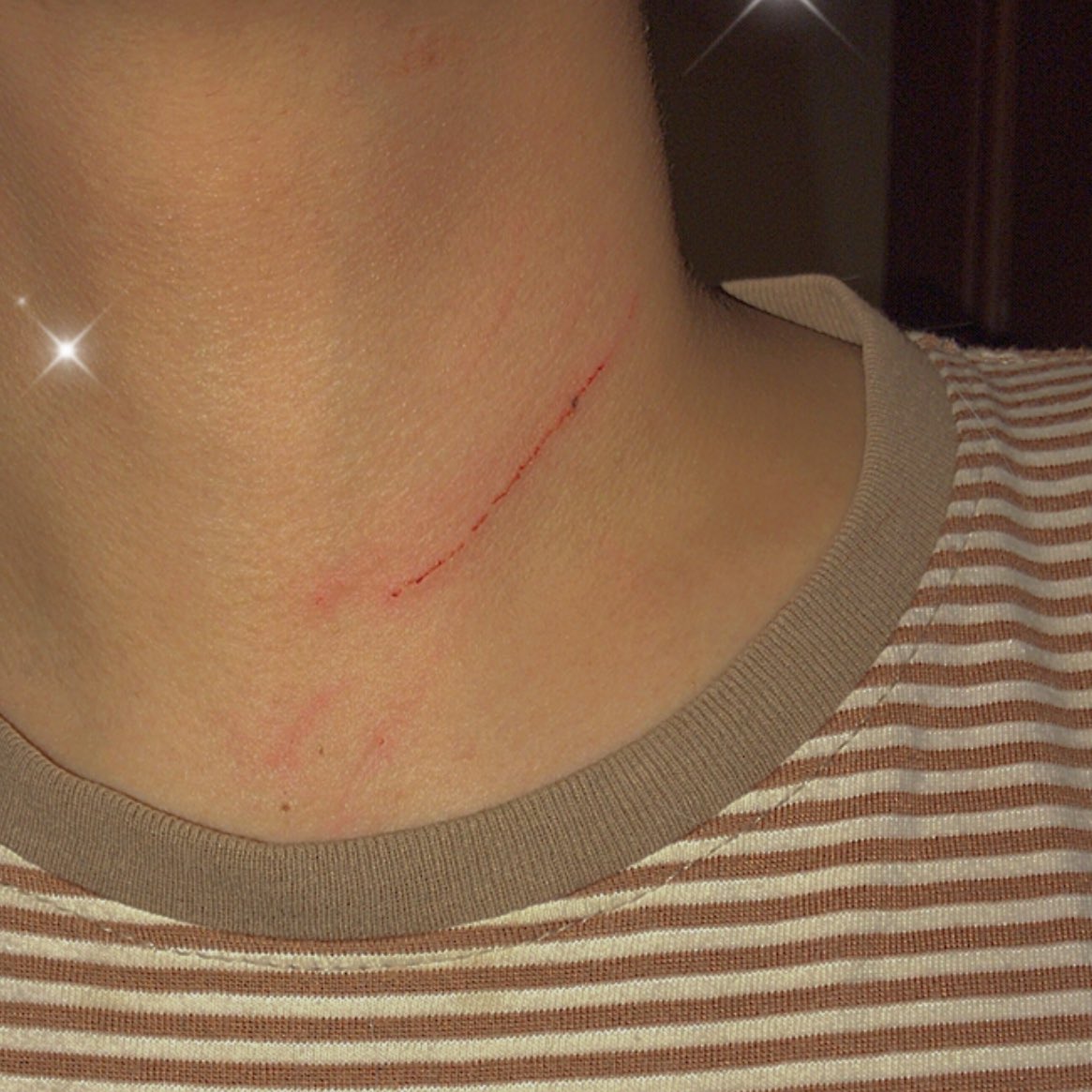 บอกแล้วว่าไม่ชอบให้ทำรอย ละรอบนี้ที่คอเลย เทอมันยัยตัวดี !