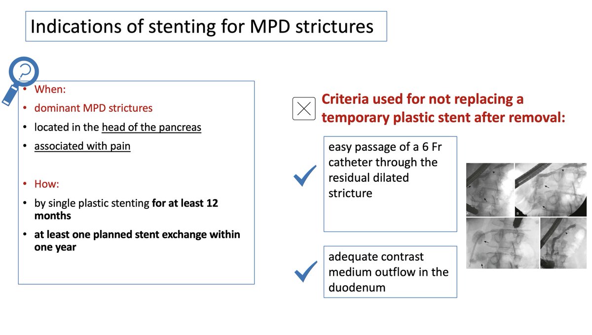 KM_Pawlak's tweet photo. Dominant and refractory MPD strictures - definition and treatment

Available in @UEGJournal 

United European Gastroenterology evidence-based guidelines for the diagnosis and therapy of chronic pancreatitis (HaPanEU)
https://t.co/6JmRcNEU6d https://t.co/7z858QAvSS