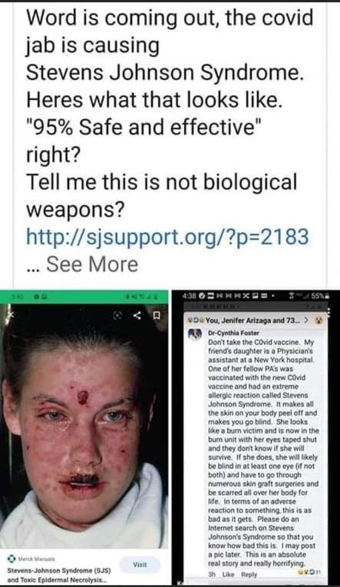 More Covid vaccine reactions...