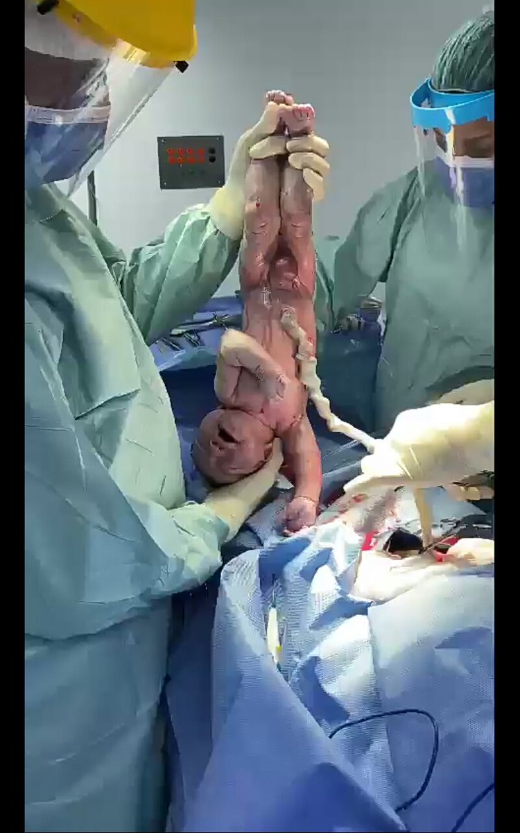 garrido_dr's tweet photo. Bienvenido al 🌎👶

#2Enero #Venezuela #Enero2021 #cuarentena #Caracas #medicosencaracas #anonuevo2021 #CuarentenaRadical #ginecologosencaracas #drgarrido #bebe https://t.co/8ceVUh42mV