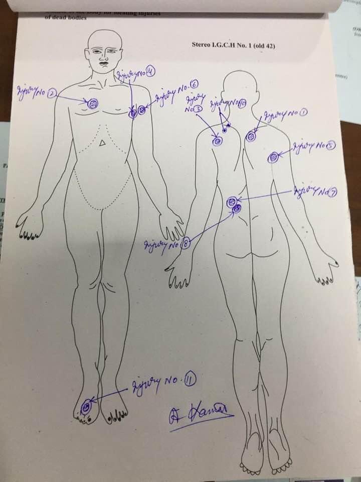 AsadAToor's tweet image. #BREAKING: postmortem report of Usama is evidence of #Islamabad police brutality, bullet holes showing how they killed a 22 years old student in alleged fake encounter. 1/2
#JusticeForUsamaNadeemSatti #IslamabadPolice
