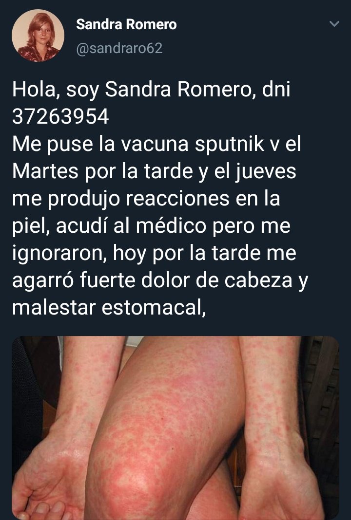 PellizaCarla's tweet photo. La vacuna rusa no te convierte en comunista, en realidad te hace buscar fotos en Google y publicar fake news. https://t.co/sUzp4O4zO7