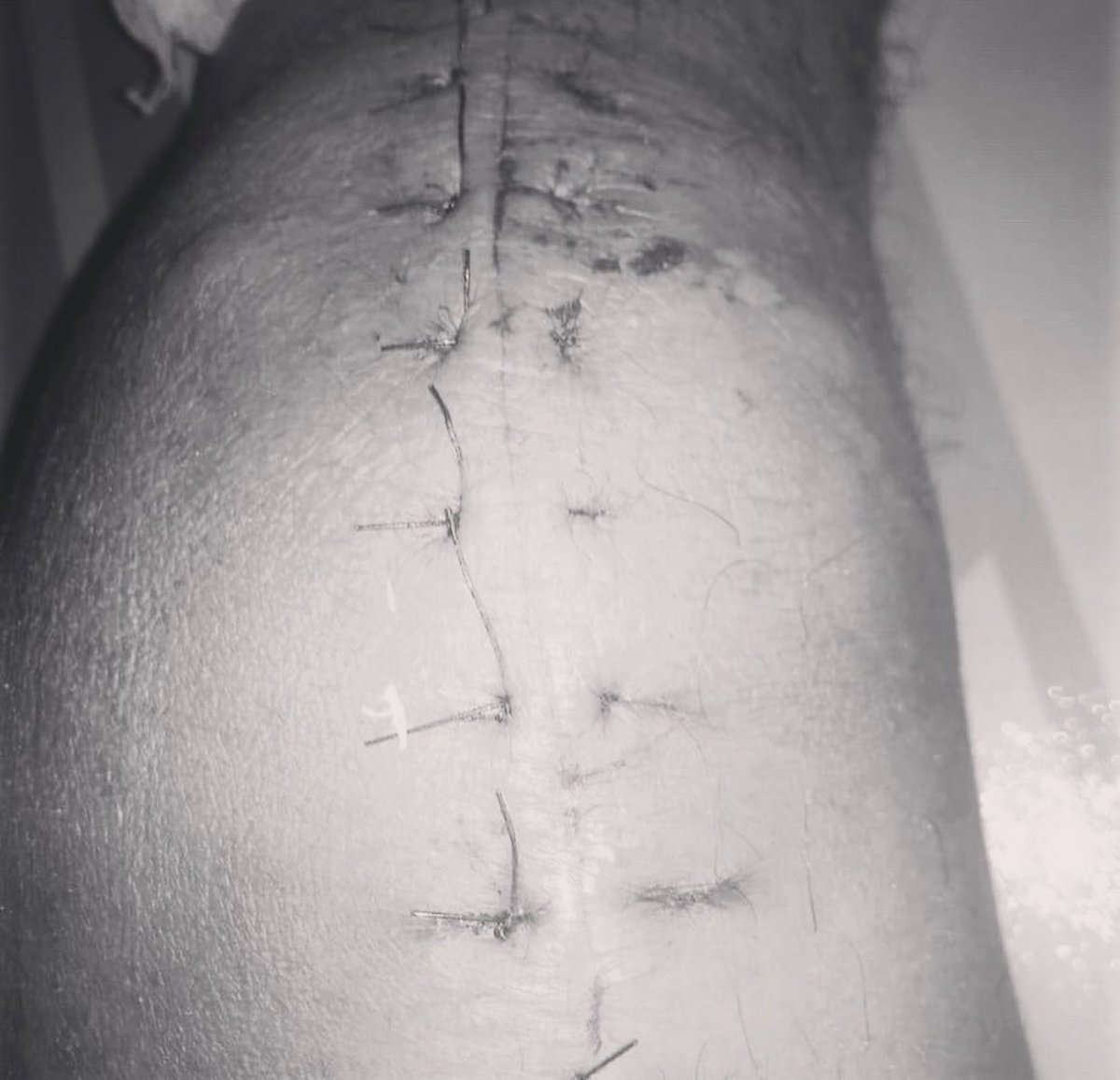 Twitter please do your magic.
Silahkan baca captionnya baik”, dan yang tergerak hatinya untuk membantu bisa hubungi bapaknya langsung Pak Uskari 082283320577 (yang bersangkutan) 🥺🙏