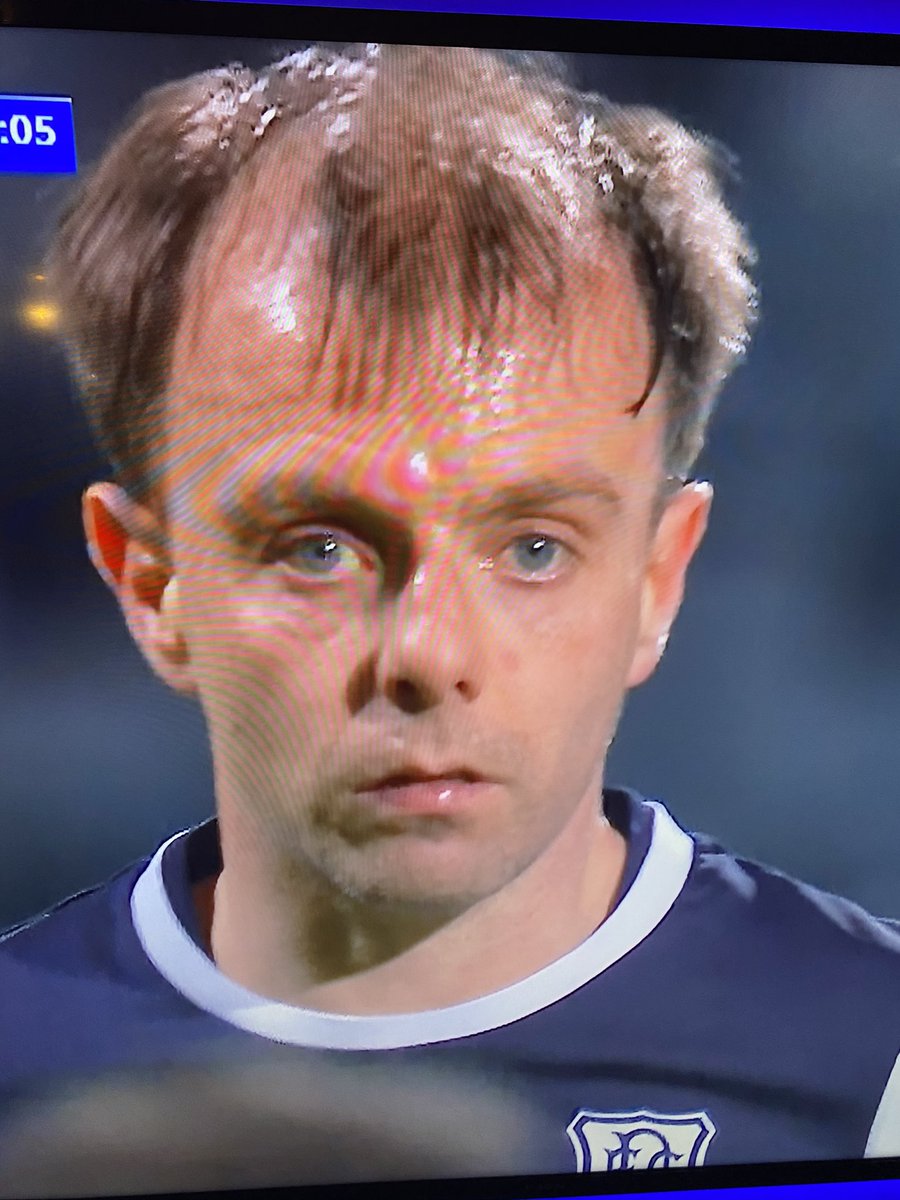 Should have to start every game on a yelly card just for that barnet