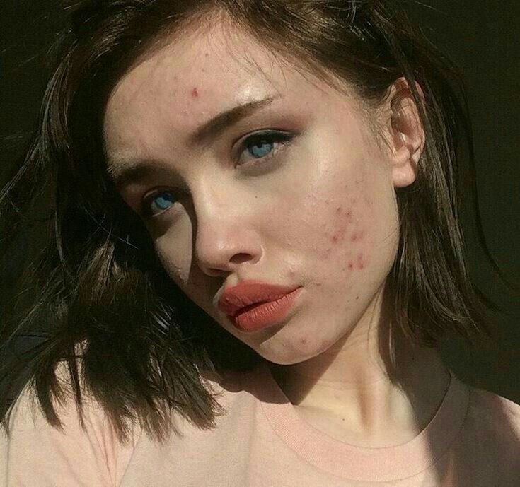 gitemch's tweet photo. Having #pimples or #acnes does not make you worthless or less beautiful. Our imperfections make us perfect. Just be the way you are and not ashamed of it. You’re worthy, beautiful and you got this. ❤️
Salvador Dali once said : “Have no fear of perfection. You’ll never reach it”. https://t.co/a3RCwjtnj9