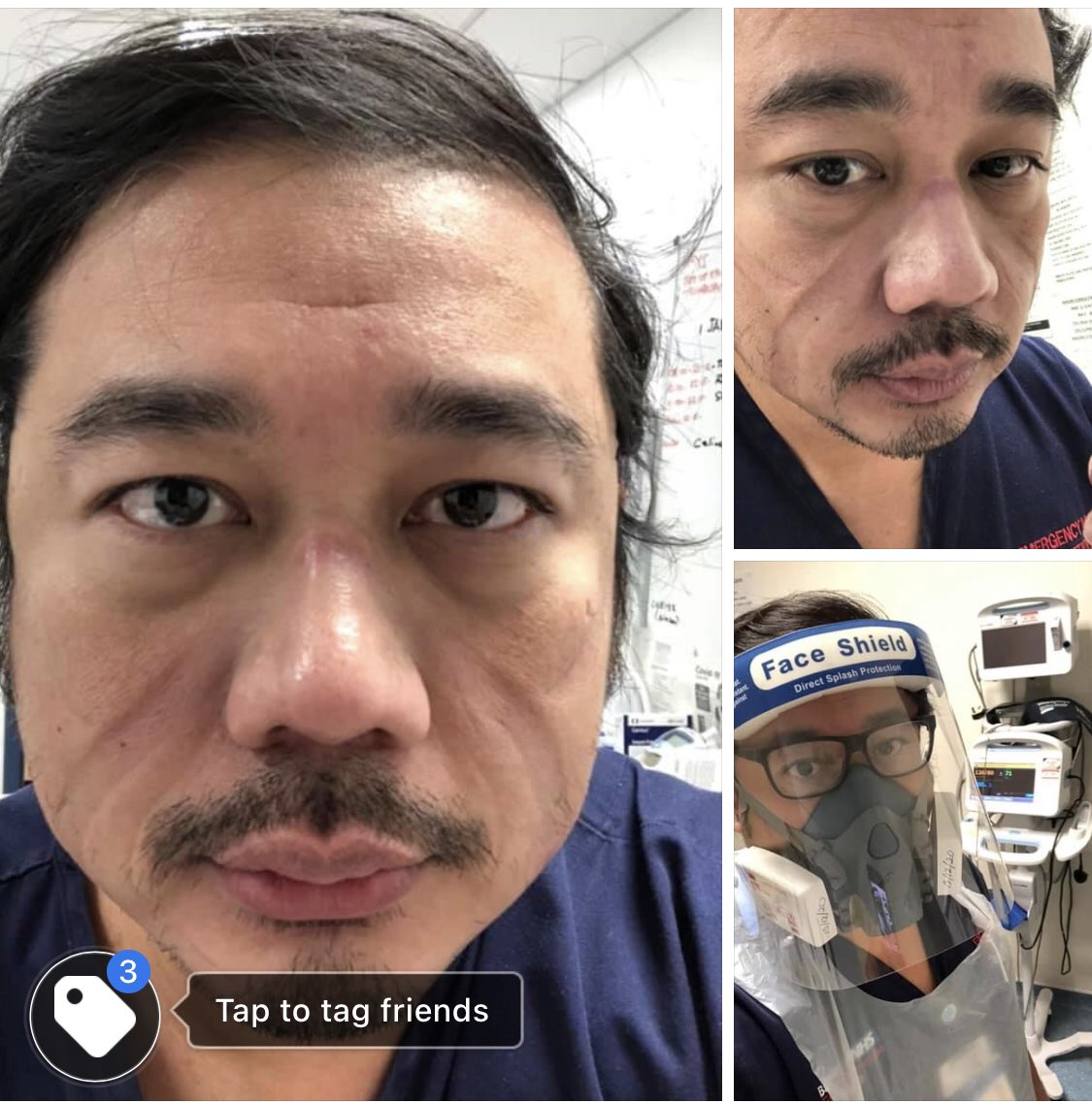 aresjay78's tweet photo. This is me after working New Year’s Eve and New Year’s Day back in A/E. #COVID19 https://t.co/mLvo7vsyKS