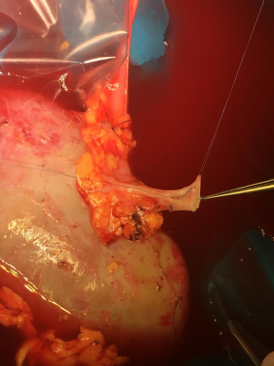 Chris Nahm tweet media