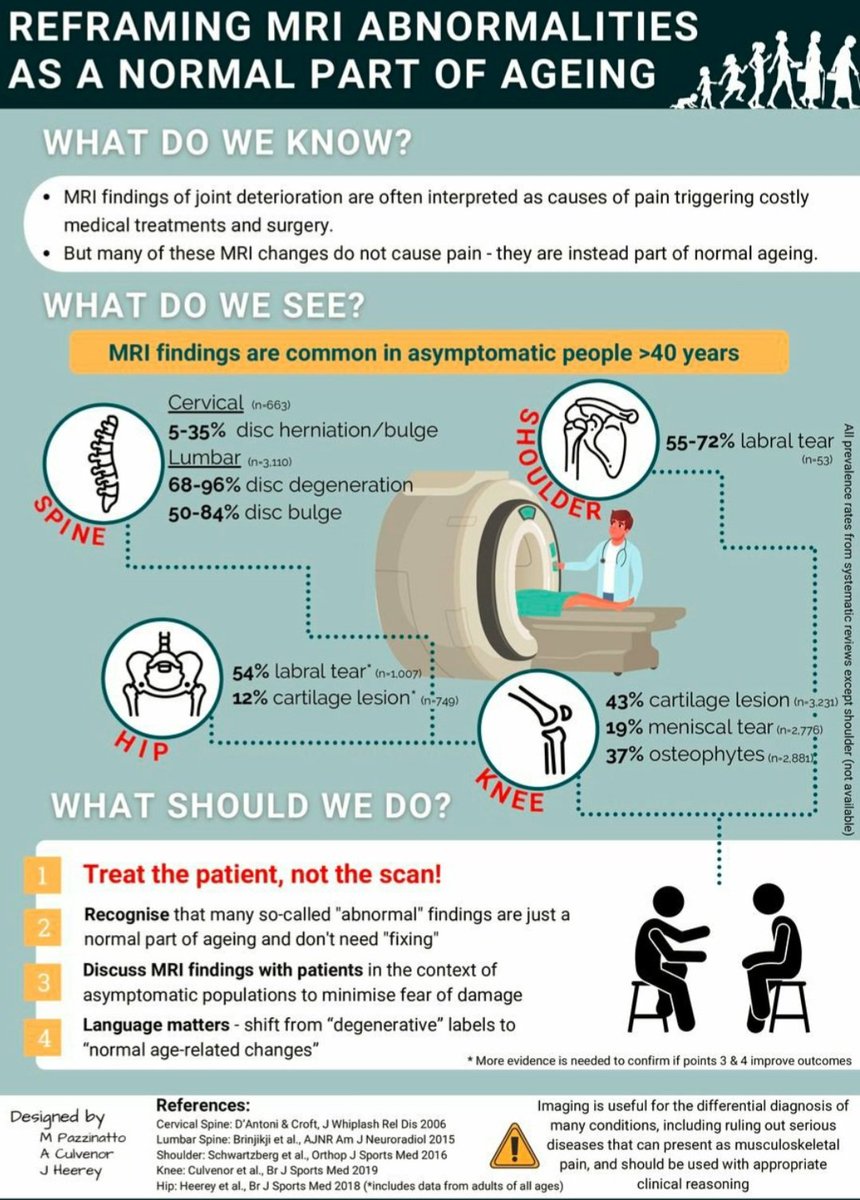 La Trobe SEMRC (@latrobesem) on Twitter photo Original Research: "Treat the patient, not the scan"
<a href="/agculvenor/">Adam Culvenor</a>, <a href="/JHeerey/">Dr Joshua Heerey</a> & <a href="/M_Pazzinatto/">Marcella Pazzinatto</a> re-frame "abnormal" MRI findings as a normal part of aging - just like wrinkles on the skin!
🔎
dx.doi.org/10.1136/bjspor…
#imaging #newnormal #agerelated #paywall Original Research: "Treat the patient, not the scan"
<a href="/agculvenor/">Adam Culvenor</a>, <a href="/JHeerey/">Dr Joshua Heerey</a> & <a href="/M_Pazzinatto/">Marcella Pazzinatto</a> re-frame "abnormal" MRI findings as a normal part of aging - just like wrinkles on the skin!
🔎
dx.doi.org/10.1136/bjspor…
#imaging #newnormal #agerelated #paywall