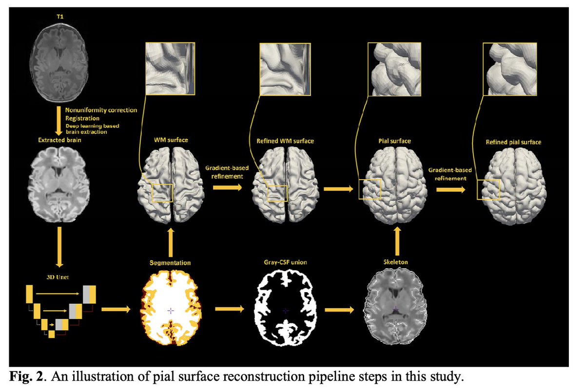 ParkvilleGeek's tweet photo. Robust T1 MRI cortical surface pipeline for neonatal brain and systematic evaluation using multi-site MRI datasets | #bioRxiv https://t.co/YbjNVYntrR https://t.co/ulQ5BUv2Ak