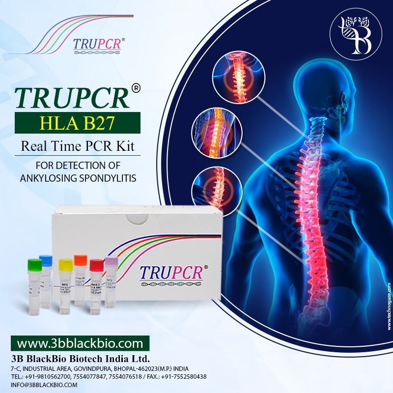 3B_BlackBio's tweet photo. Ankylosing Spondylitis is a type of arthritis that affects the spine, resulting in a rigid spine.
.
.
📞 7554077847 / 7554076518
📩 info@3bblackbio.com
🌐 https://t.co/bLVB62D21U
#Trupcr #HCV #HepatitisC #Virus #detectionkit #trancript #Genotype #3BBlackBio #Biotech #Bhopal https://t.co/EKtYs0kHCT