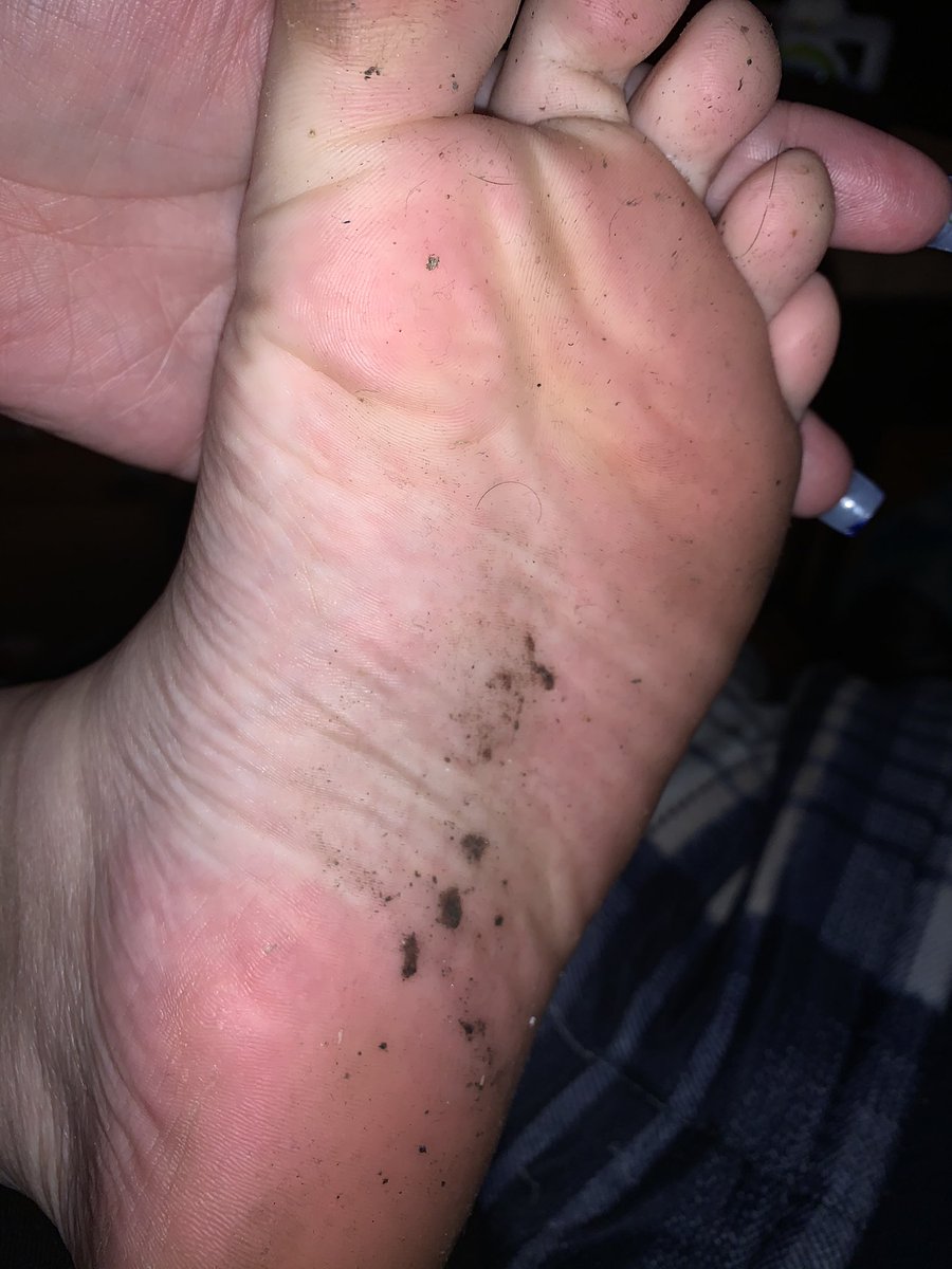PlusPrincesss's tweet photo. If only you could smell these through the screen 🤭🤭🤭

#toejam #dirtyfeet #smellyfeet https://t.co/WwxPrdLeQ6