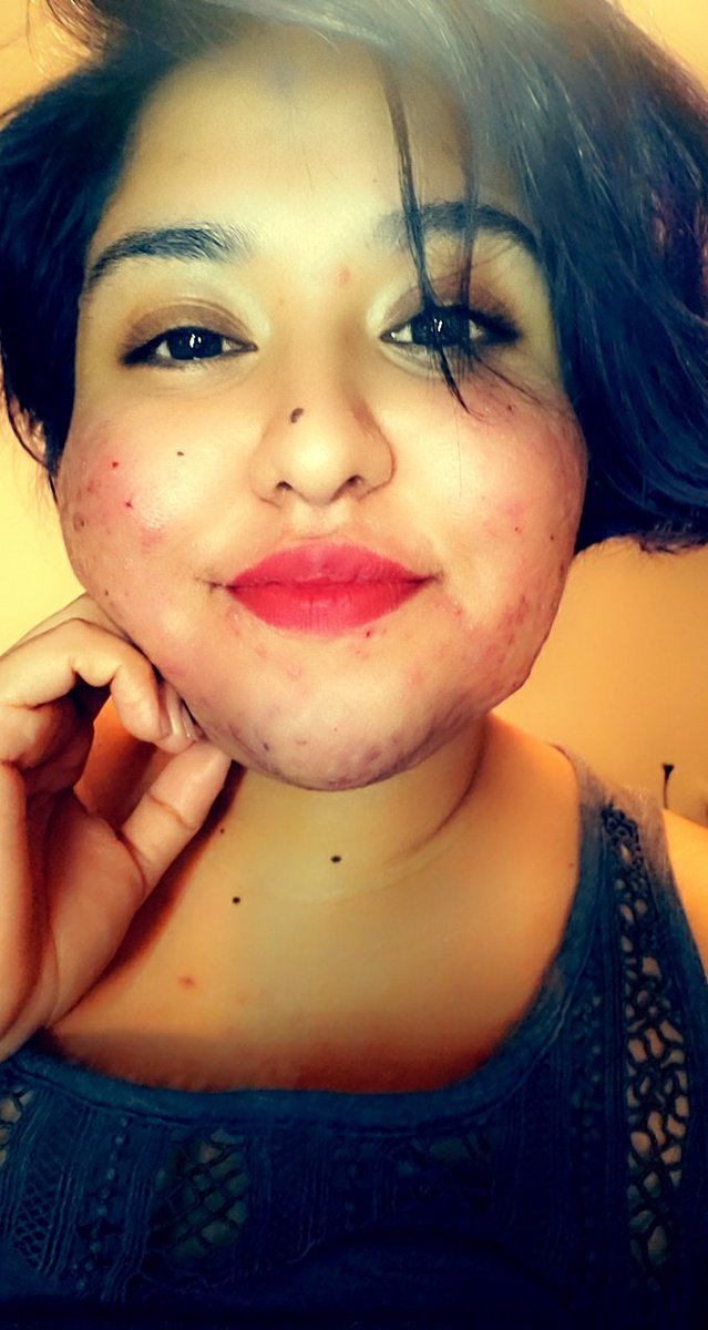 sillynaaaa's tweet photo. #redlip #NewProfilePic #LearningToLoveMe https://t.co/yUKGsogDCs
