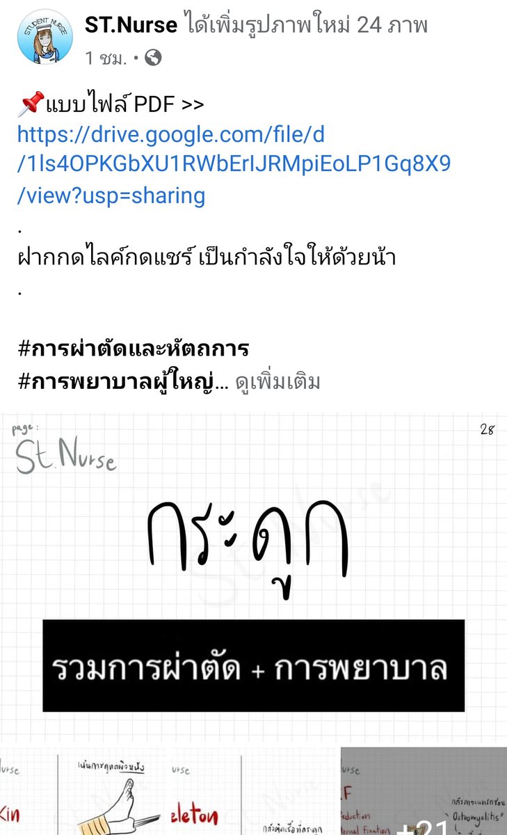Stnurse5's tweet photo. การผ่าตัด+การพยาบาลที่สำคัญ 
Part 2

ลงเพจแล้วจ้าา

👉🏻Page : st.nurse https://t.co/VWnOSfF7Ph