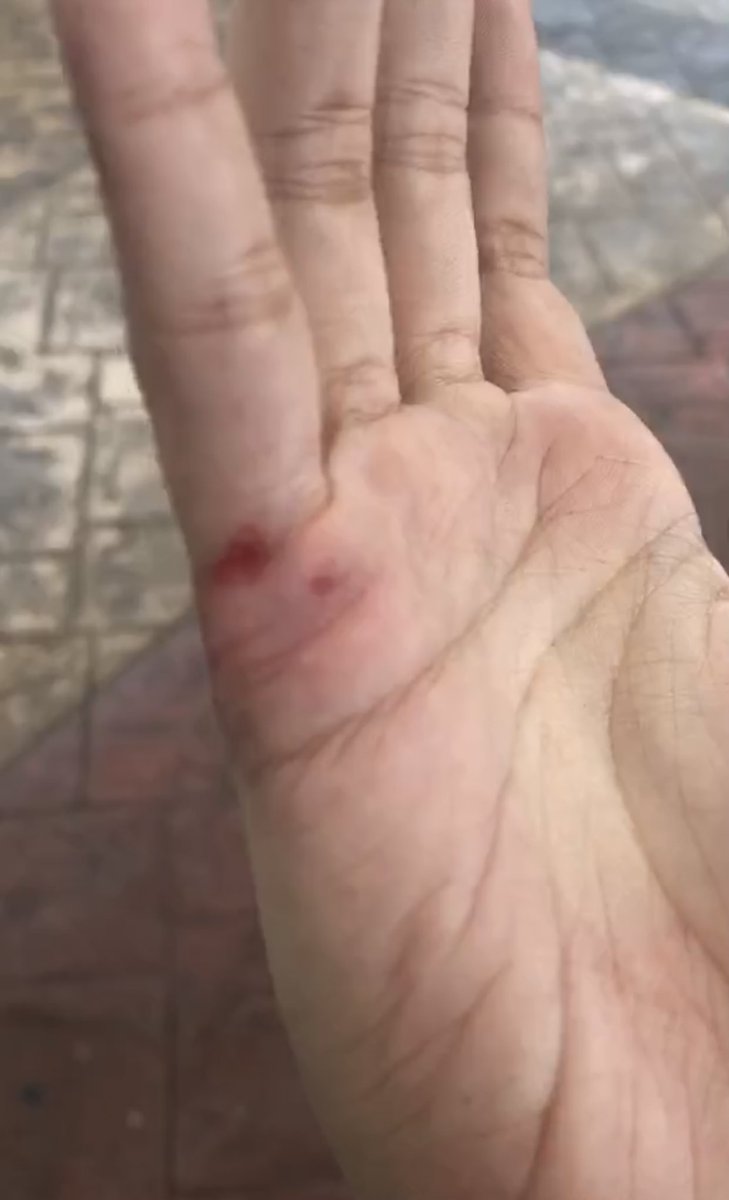 ตำรวจใช้กำลังจับกุมผู้ที่ไปเขียนป้ายผ้าที่อนุสาวรีย์ ตอนนี้กำลังถูกพาตัวไปสน.พญาไท❗️❗️❗️ 
#ม็อบ16มกรา #ยกเลิกม112