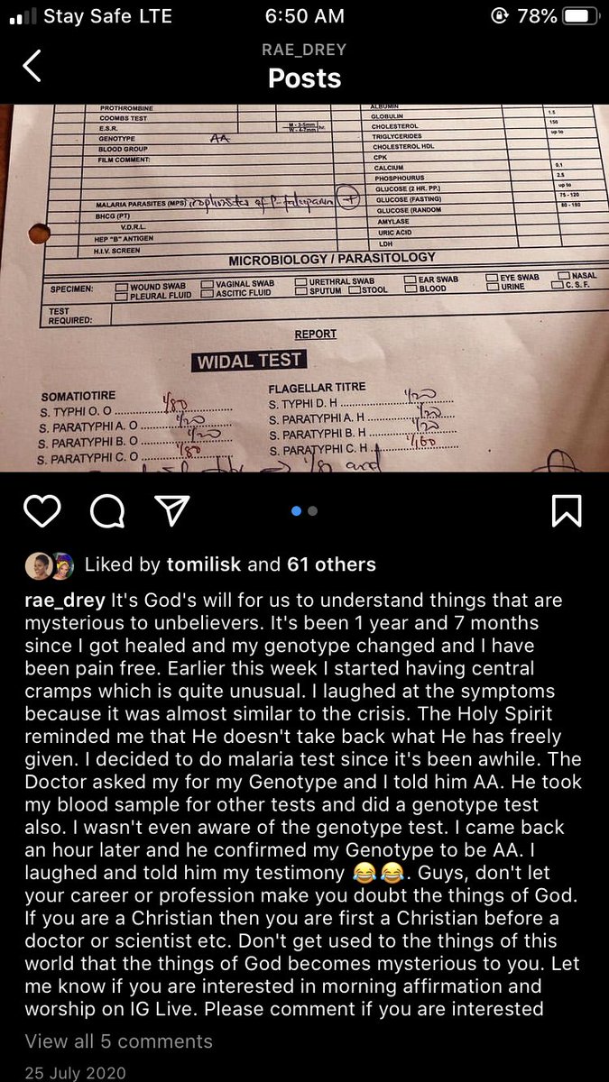 NessaAde's tweet photo. @Penuelchuks_ I am really happy for you, I’m happy your health has taken a turn. I know someone who was SS as well and God answered her prayers. Her Crisis stopped and her Genotype changed and she said she hasn’t been sick since. https://t.co/W7wvSwTJFY