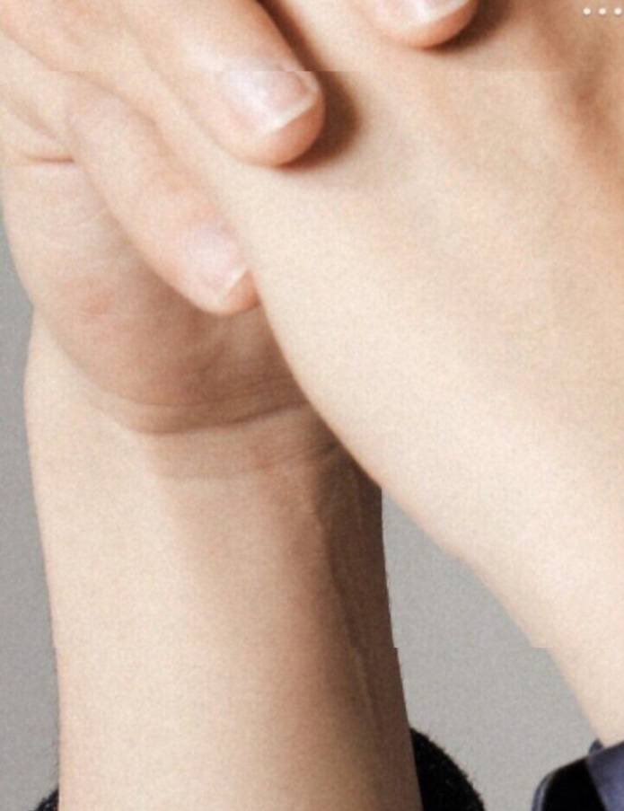 when xiao zhan does photoshoots, he doesn’t ever request that they photoshop his face, but asks that they hide the scars on his wrist and hand from when he got hurt, he’ll hide it in public and say it’s nothing if you ask him