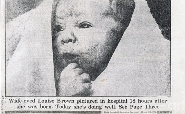 Durga (whose parental name is Kanupriya Agarwal) was announced the India's first and world's second test tube baby who was born 67 days after the birth of the world's first test tube baby named Louis Brown. RG Edwards was awarded nobel prize in 2010 for his achievement. +