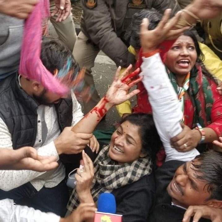 SevadalBR's tweet photo. ये तस्वीरें गवाह है कि कांग्रेस के हर सिपाही ने हमेशा इस मिट्टी के लिए अपना लहू गिराया है, लेकिन कभी फांसीवादी ताकतों के सामने घुटने नही टेके ।

मैं @LambaAlka जी के शीघ्र स्वास्थ्य लाभ की कामना करता हूँ । https://t.co/w2lnjL23UP