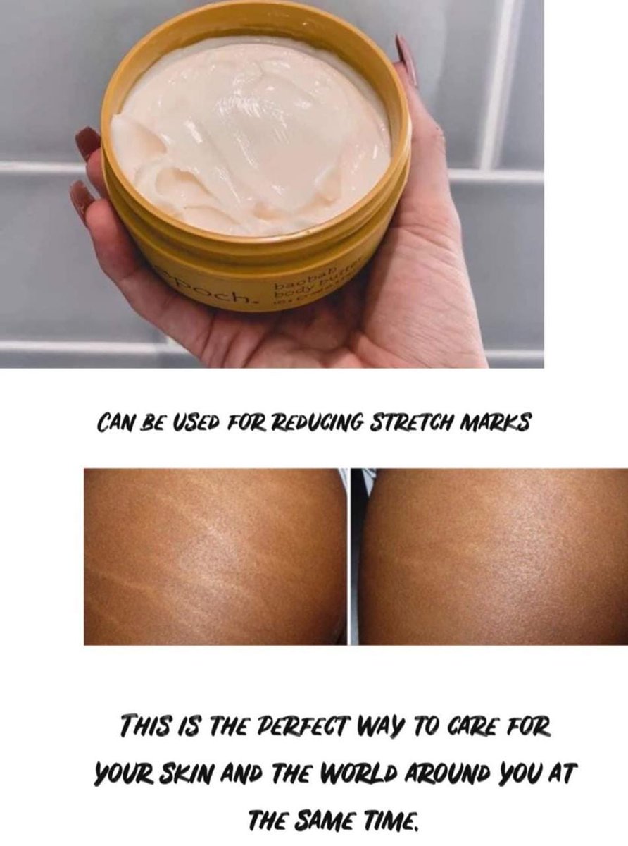 kaMazibukoBusi's tweet photo. 3 reasons why youโll love Epoch Baobab Body Butter:
๐ INCREASES: Skinโs moisture, natural barrier functions, and appearance
๐ PROMOTES: Smoother and more toned-looking skin
๐ ENHANCES: Resilience over time.
WhatsApp 0714135429
Sjava
Emtee
Thembi
#IfIWinLotto https://t.co/FuLPzjSbre