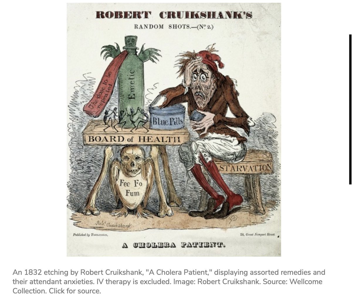 ISNeducation's tweet photo. A pandemic led to IV fluids! William Brooke O’Shaughnessy (an Irish physician fresh out of med school,1831)observed in cholera patients that large amounts of water, electrolytes had been leeched from the blood and lost in stool.His solution->replenish it #NephHistory #NephTwitter https://t.co/KwOjg6AkhL
