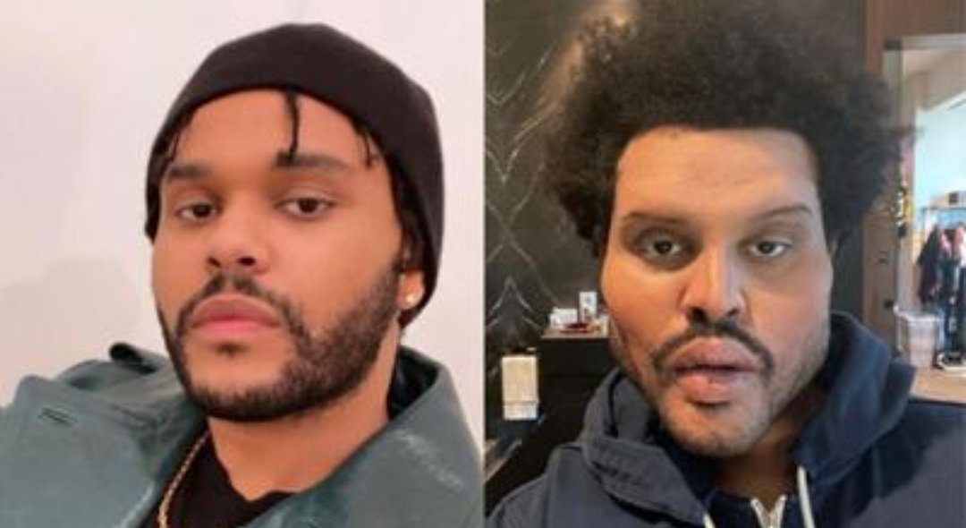 _NetizenNews's tweet photo. The Weeknd's face freaks some people out
#NetizenNews
The singer has made appearances recently at awards shows and in music videos with what appeared to be a bruised, bloodied and bandaged face.
Now he's freaked some of his followers out with yet another new look. https://t.co/8UJ8Wmhnml