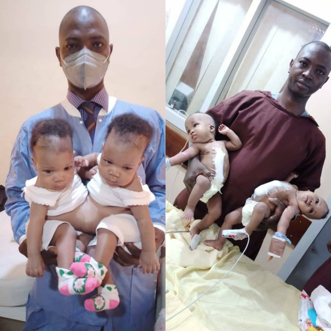 iam_stmichael's tweet photo. Conjoined female twins separated at The University of Ilorin Teaching Hospital!!!.

This is massive,congratulations to the team,the parents of the beautiful girls &amp; Kwara at large!!!. https://t.co/Qn45Sea2Ii