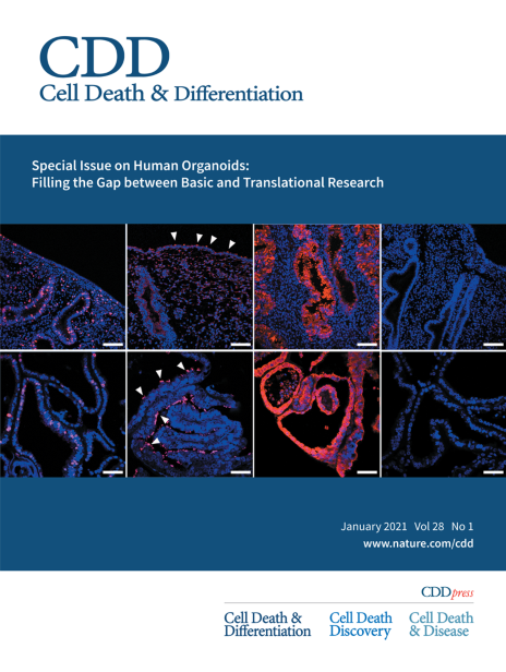 KonsNikol's tweet photo. I am so happy and proud to see our immunofluorescence image on the @cddpress cover!  🥳Our image features markers of proliferation and differentiation expressed in human endometrial tissue and endometrial organoids. 🔬
We did it @lo0ma Margherita Turco 👏
https://t.co/EvQNzhrvyT https://t.co/bQbsyngkUK