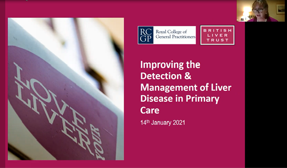 LiverUK_charity's tweet photo. We're incredibly proud to have hosted our first ever online #liver training session for UK #GPs! 

Thanks to all 160 GPs who attended and to our fantastic speakers. 

For a summary of the event and GP resources, visit > https://t.co/A0SFiDESq7 https://t.co/d9GBK0ZKDb