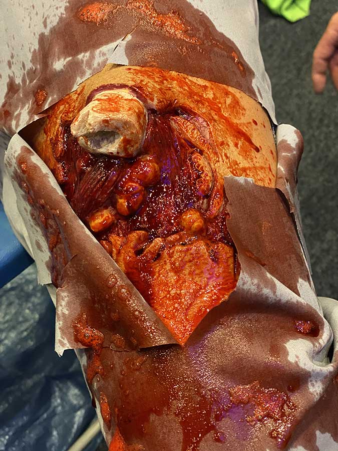 MaxprevenS's tweet photo. 🤕 Simulación de heridas en latex. 
🧯🔥 Perfectas para tu próximo simulacro  ejercicio.

#prevención #riesgos #riesgoslaborales #prl #tecnicoprevencion #Seguridadysaludeneltrabajo #accidentelaboral #accidentes0 #accidentetrabajo https://t.co/OI7iKcac5r