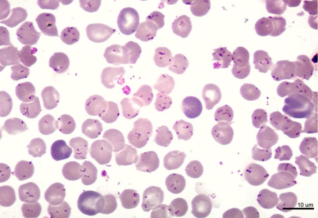Weekend Digest

Name the disease, its pathogen and treatment. 

Clues: Andes, fever, hemolytic anemia, high fatality if untreated
