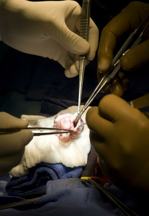 January 16, 2010 Hopeful but anxious, we waited with family and friends, getting periodic updates from the OR.Time passed very slowly. #GoChristophergo  #thebeatgoeson  #DonateLife6/