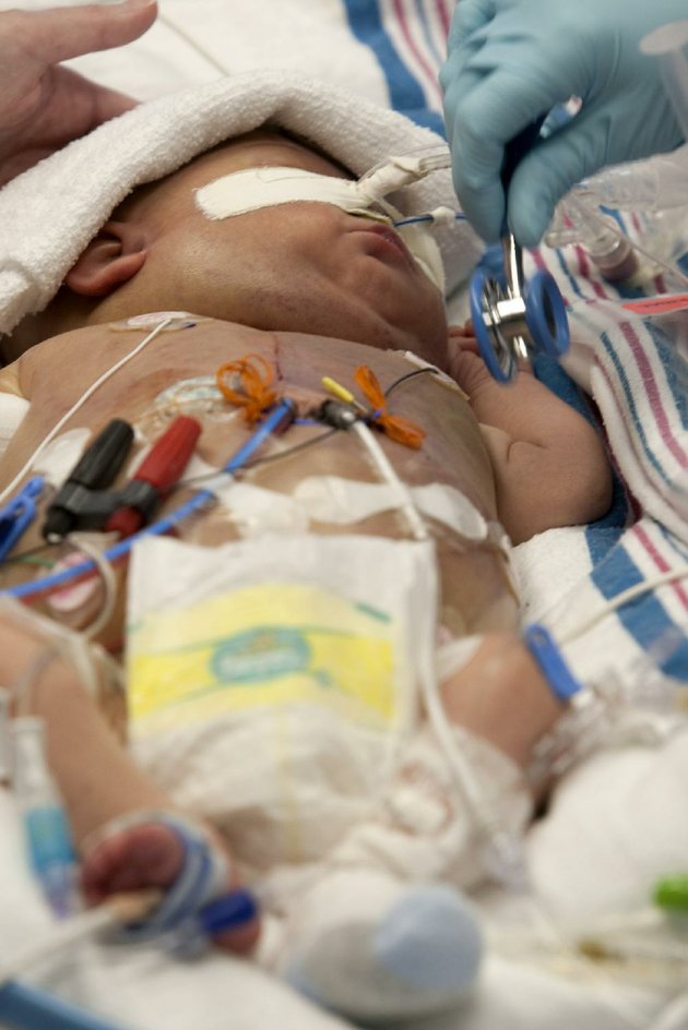 January 16, 2010 At 3:44 p.m. the new heart was in place. The surgeon, Dr. Robert “Jake” Jaquiss, told us:“That’s one of the happiest hearts I’ve seen in a while.”Suddenly our hearts were very happy, too. #GoChristophergo  #thebeatgoeson  #DonateLife7/