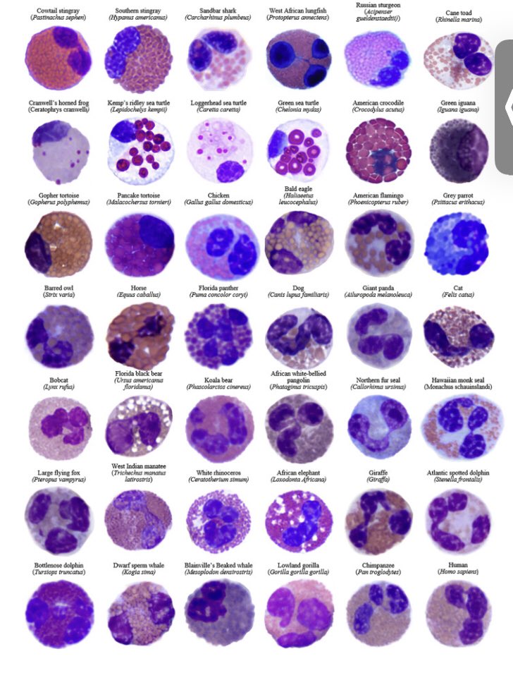 KhouryMD's tweet photo. A tribute to #eosinophils @jacionline #EosFunFacts

https://t.co/V3zcLuqhAO https://t.co/pflMDTsDqG