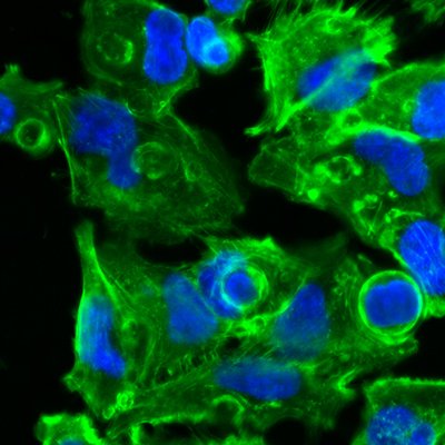 AdvPortfolio's tweet photo. This image of a new membrane to model the complex environment of the lung actually comes with its own game of hide and seek. Can you spot the the rhino, fish, hedgehog, and snail? @AliDoryab @DWagnerLab @HelmholtzMunich
View more #ScienceInPictures here: https://t.co/ZWIVp77gZ9 https://t.co/bjUud9H2QP