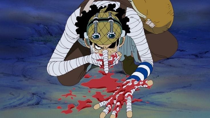 𝐋Ø𝐀𝐃 - O Givanildo على X: Luffy calvo. O destino dele é triste  #ONEPIECE  / X