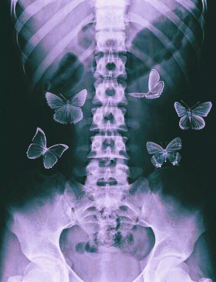 blueberrixx's tweet image. wszyscy dodają te zdjęcia i ja sb wtedy myślę "chciałabym mieć taki prosty kręgosłup" XDDDD